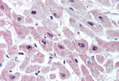 Immunohistochemistry-Paraffin: Kir3.1 Antibody [NBP3-14384] - Immunohistochemistry of formalin-fixed, paraffin-embedded human heart after heat-induced antigen retrieval.